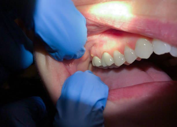 Best Emergency Dental Surgery in Thorofare, NJ